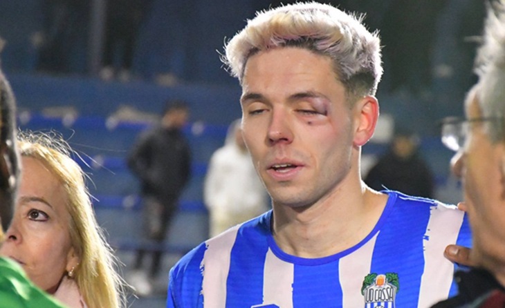 Cassà, agressió